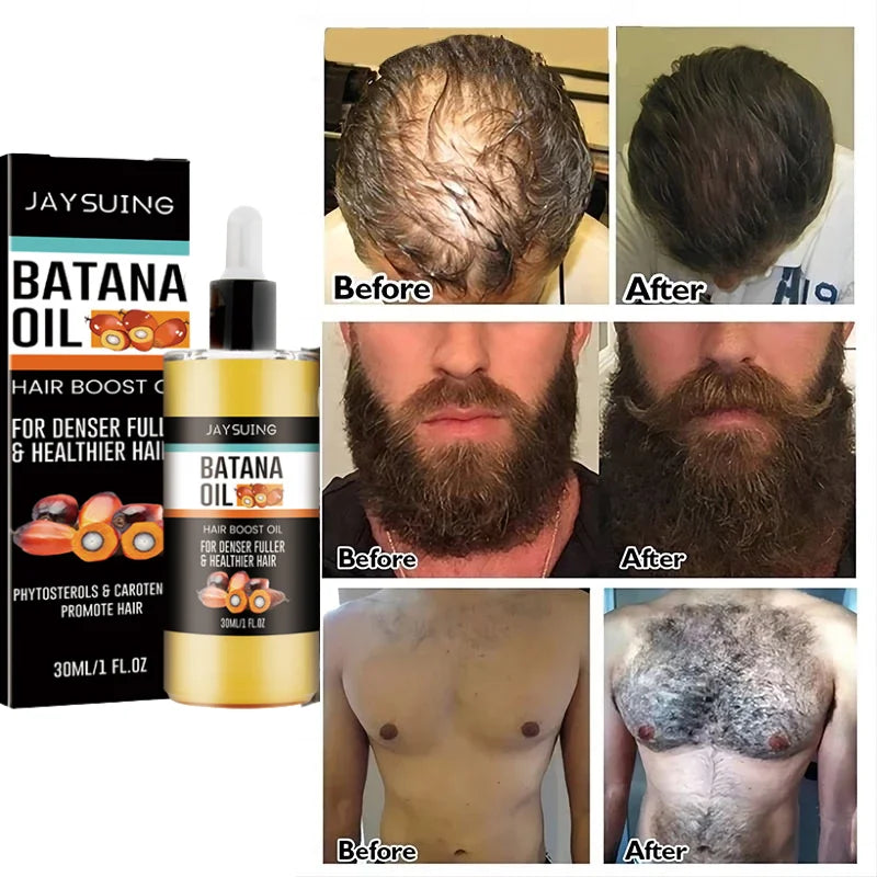 Hair Rescue Growth Kit