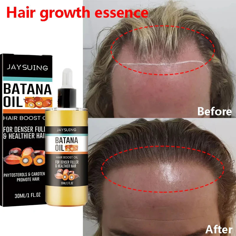 Hair Rescue Growth Kit